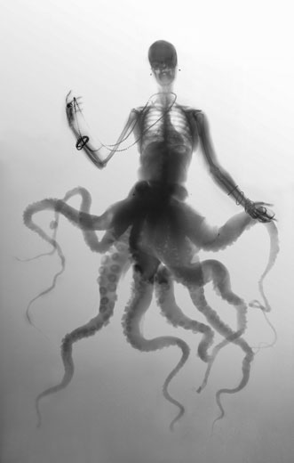 Illustration for article titled Hybrid X-ray images of bird people and octopus women
